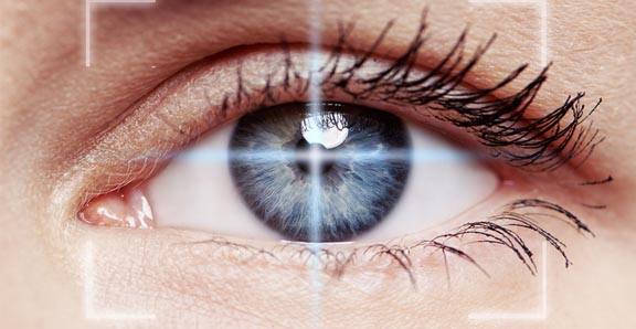 Lasik